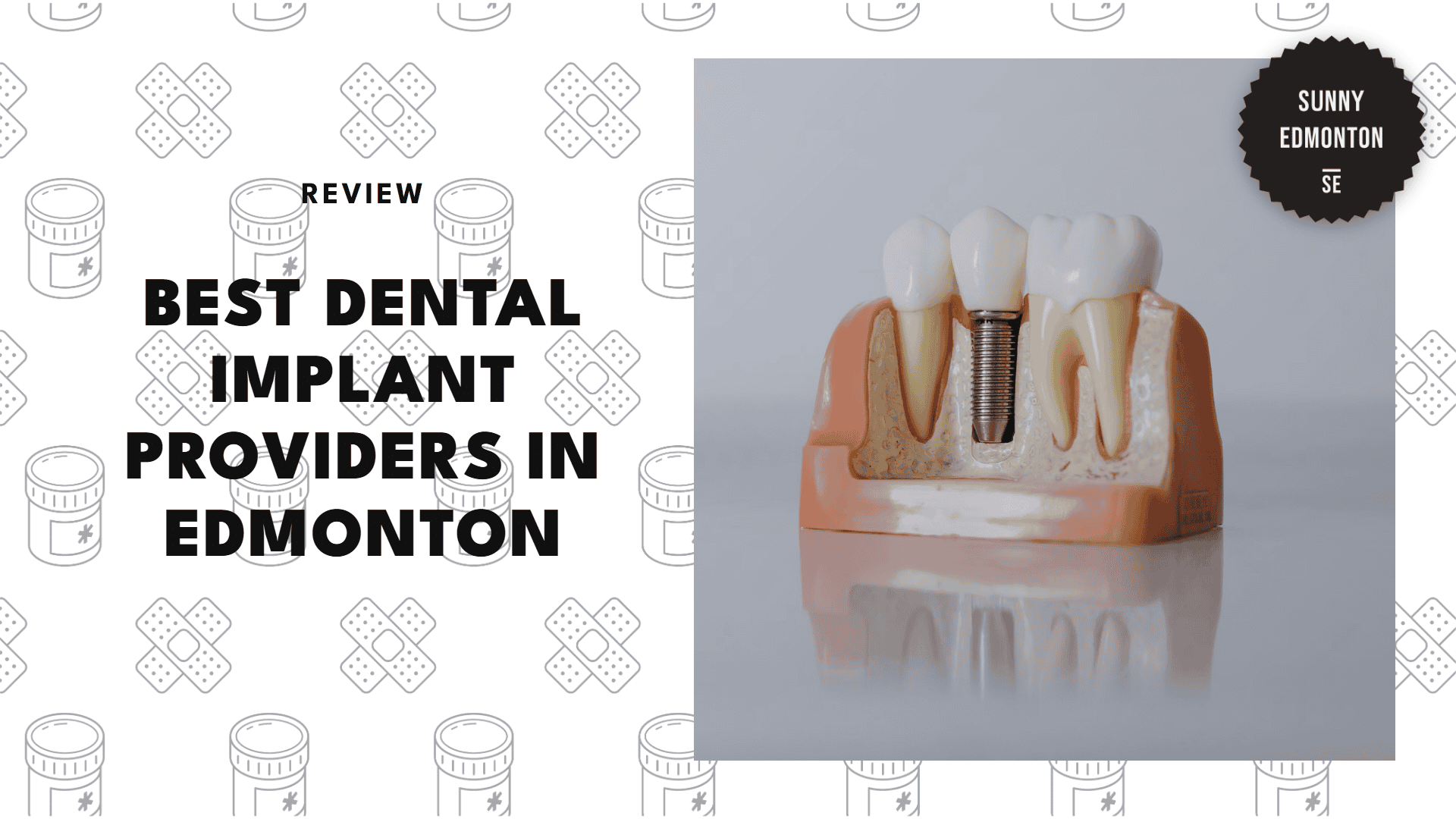 best-dental-implant-edmontonental-implant-edmonton