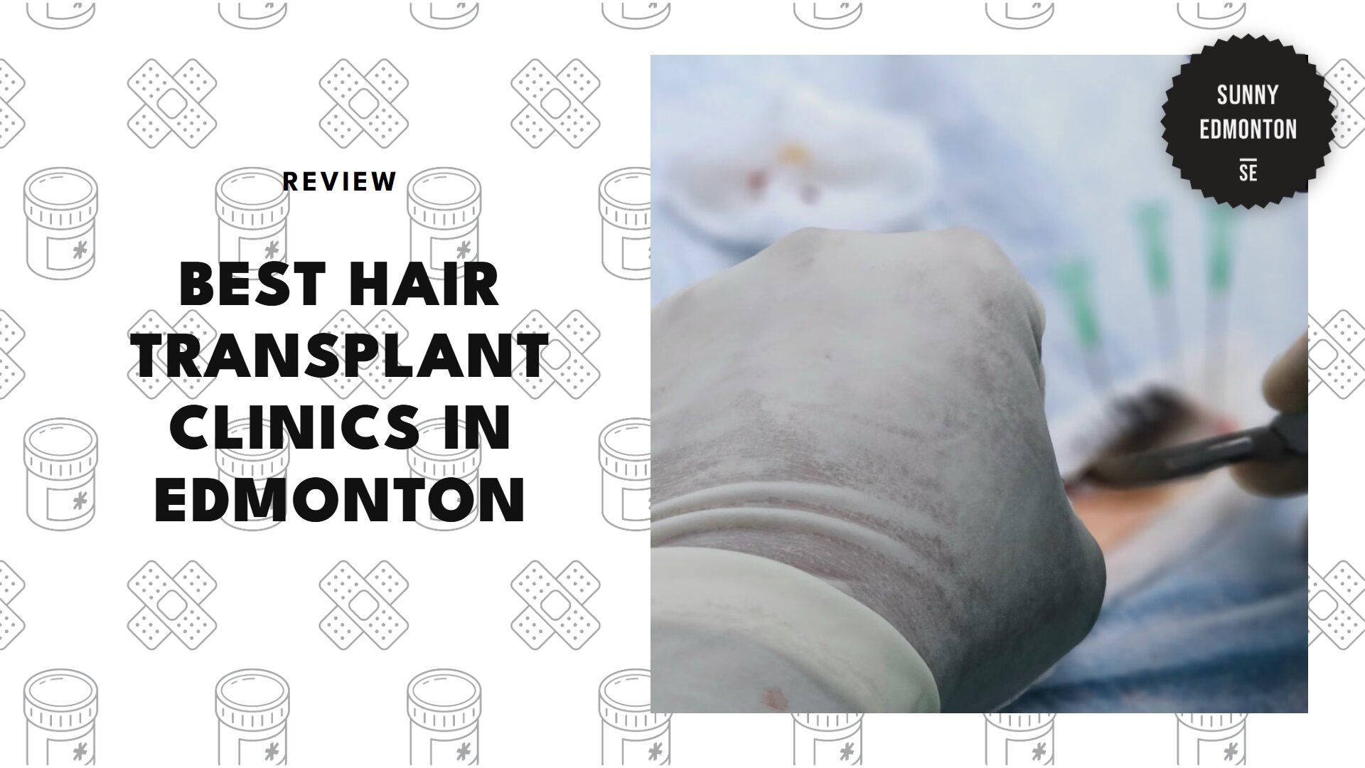 best-hair-transplant-edmonton-banner