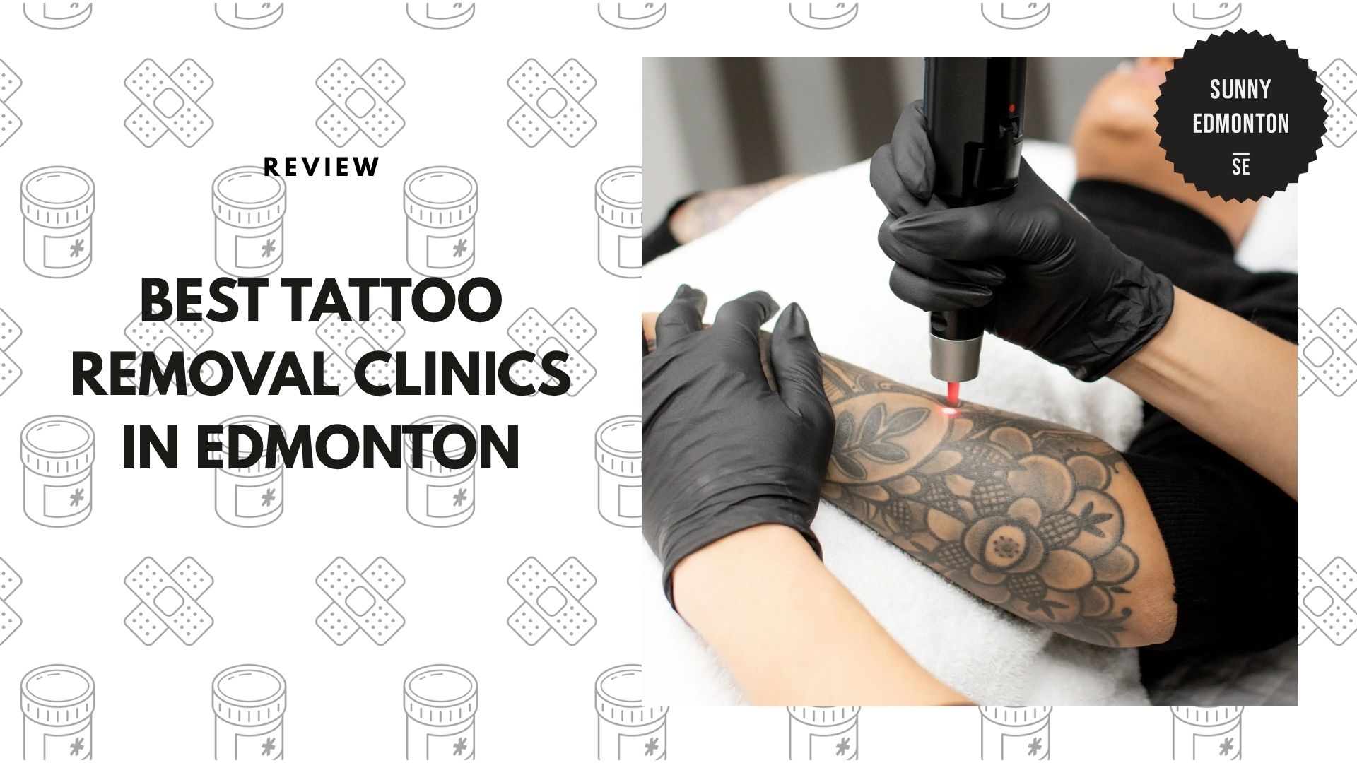 best-tattoo-removal-edmonton-banner