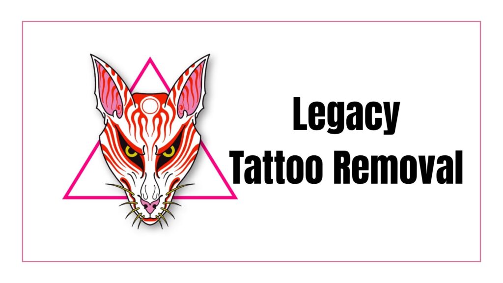 legacy-tattoo-removal-limited-logo